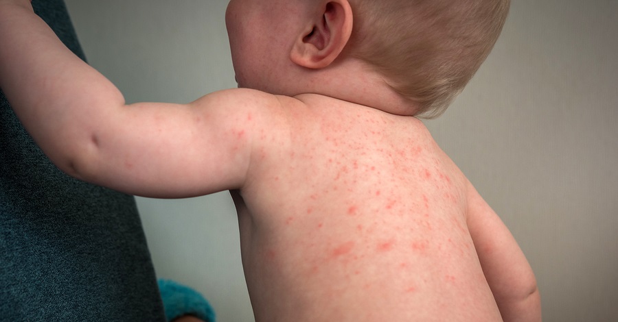 Vaccinaties voorkomen veel verdriet
